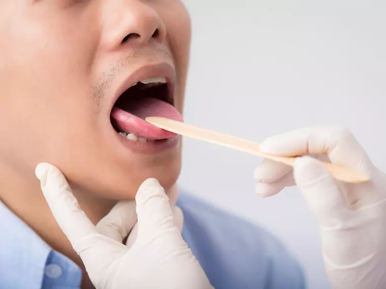 Ślina - zaburzenia wydzielania