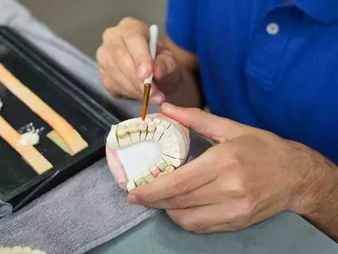 Koronka czy licówka – co wybrać?